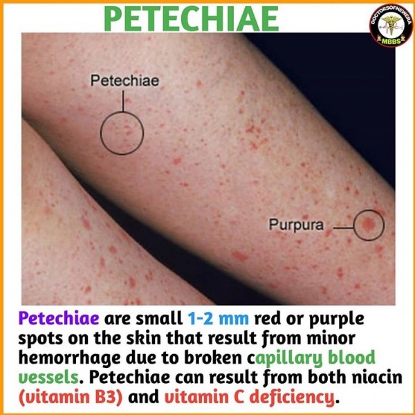 red spots on skin, symptoms