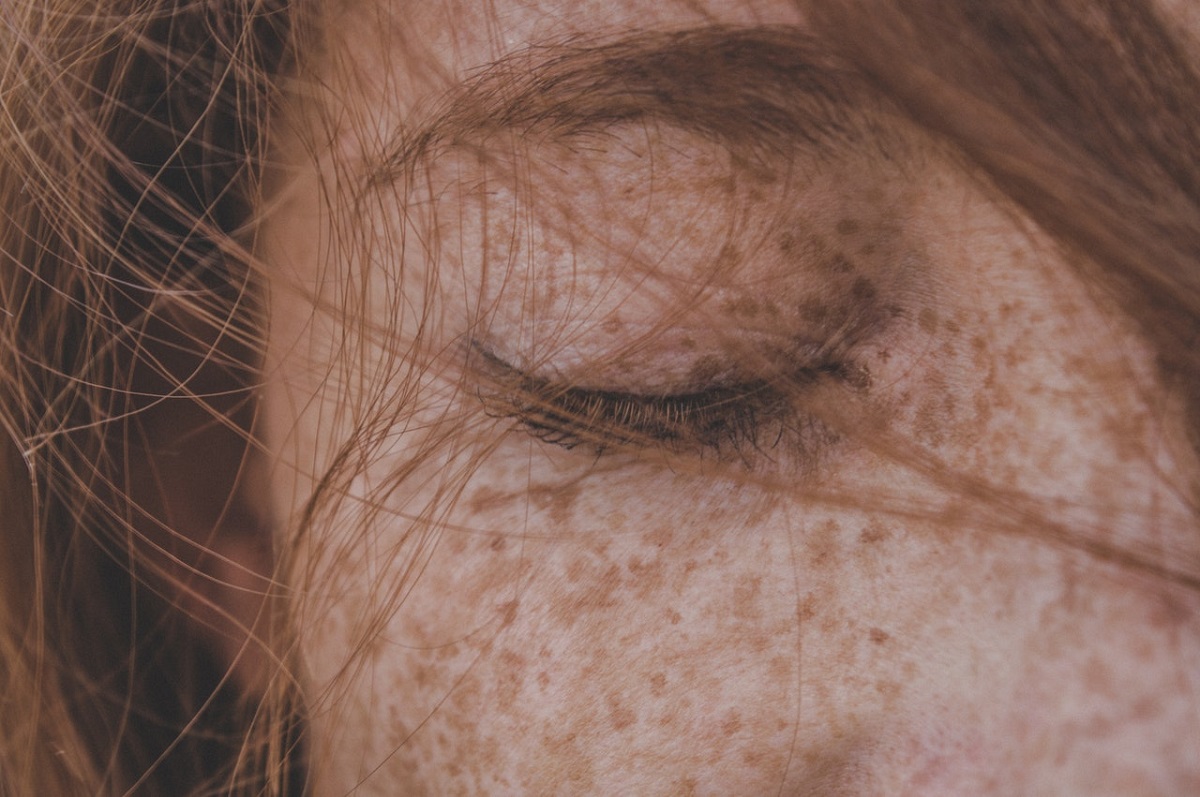 red spots on skin, symptoms