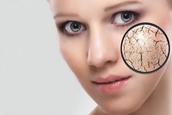 What Is a Face Balm and What Are Its Benefits? What Is a Face Balm and What Are Its Benefits?