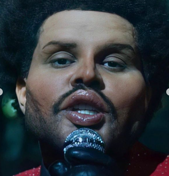The Weeknd’s Shocking New Look Is Thanks To Clever Prosthetics 
