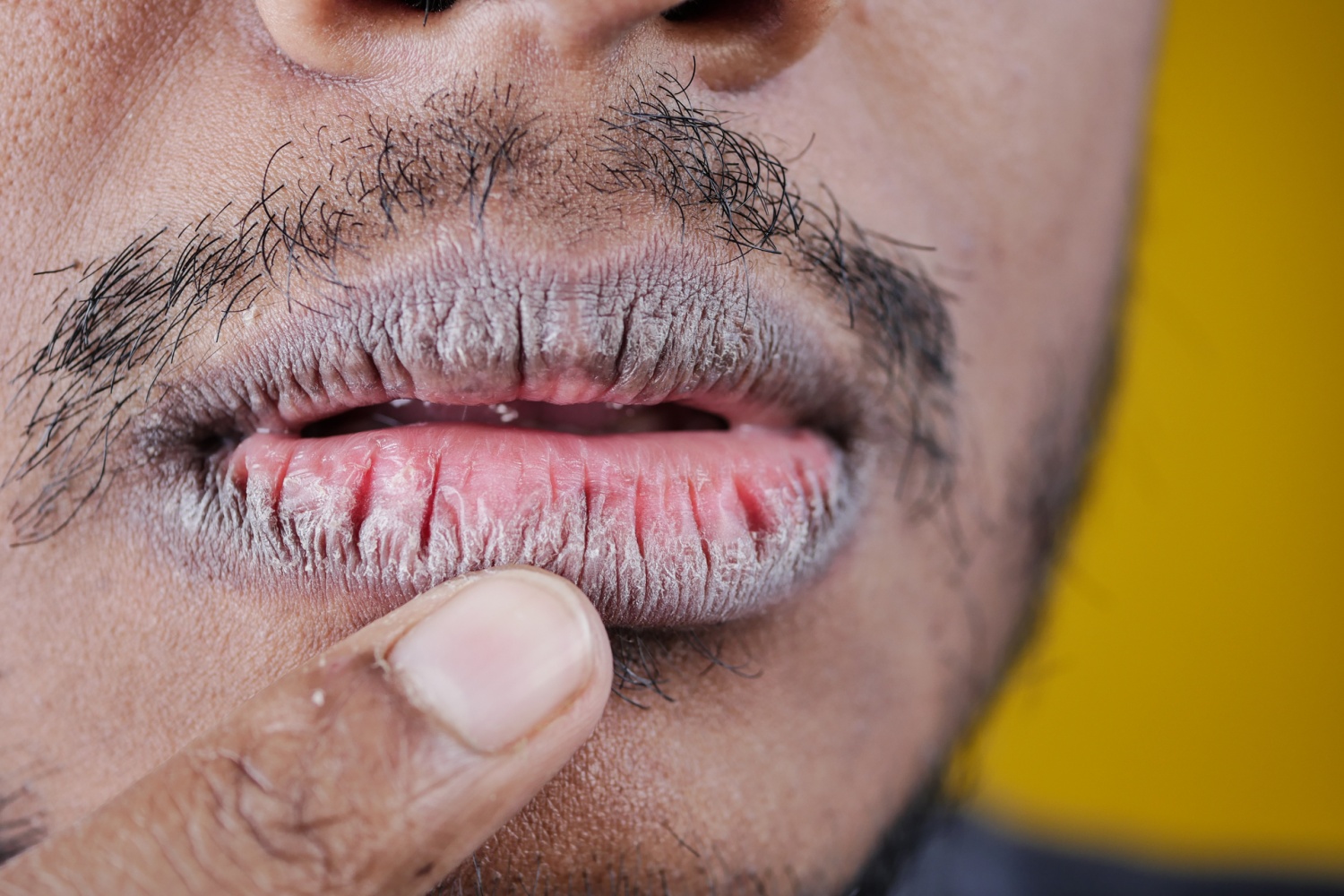 Lip Balms for Men With Dry, Chapped Lips