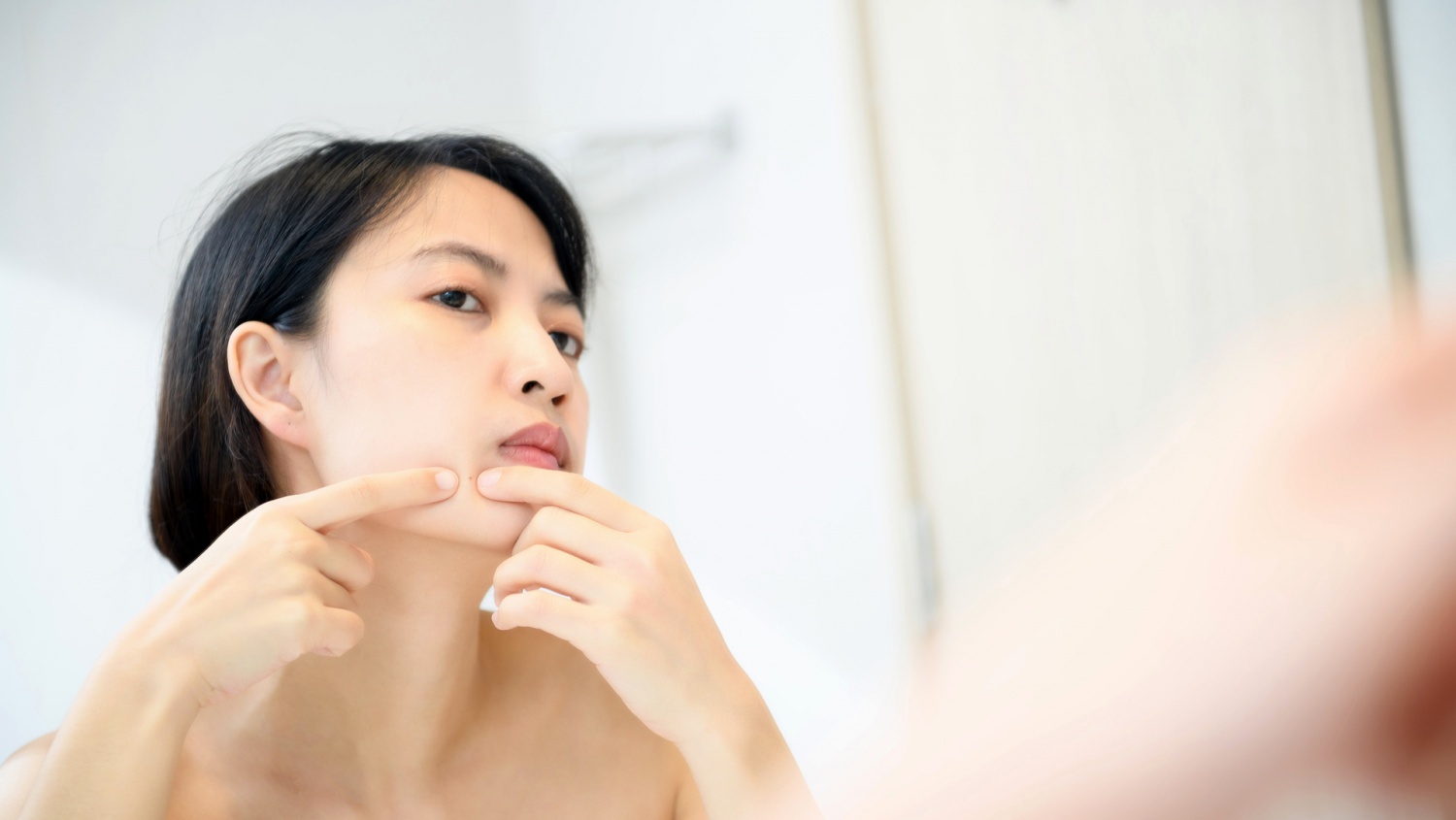 Problematic Blackheads? Here's What You Should Do