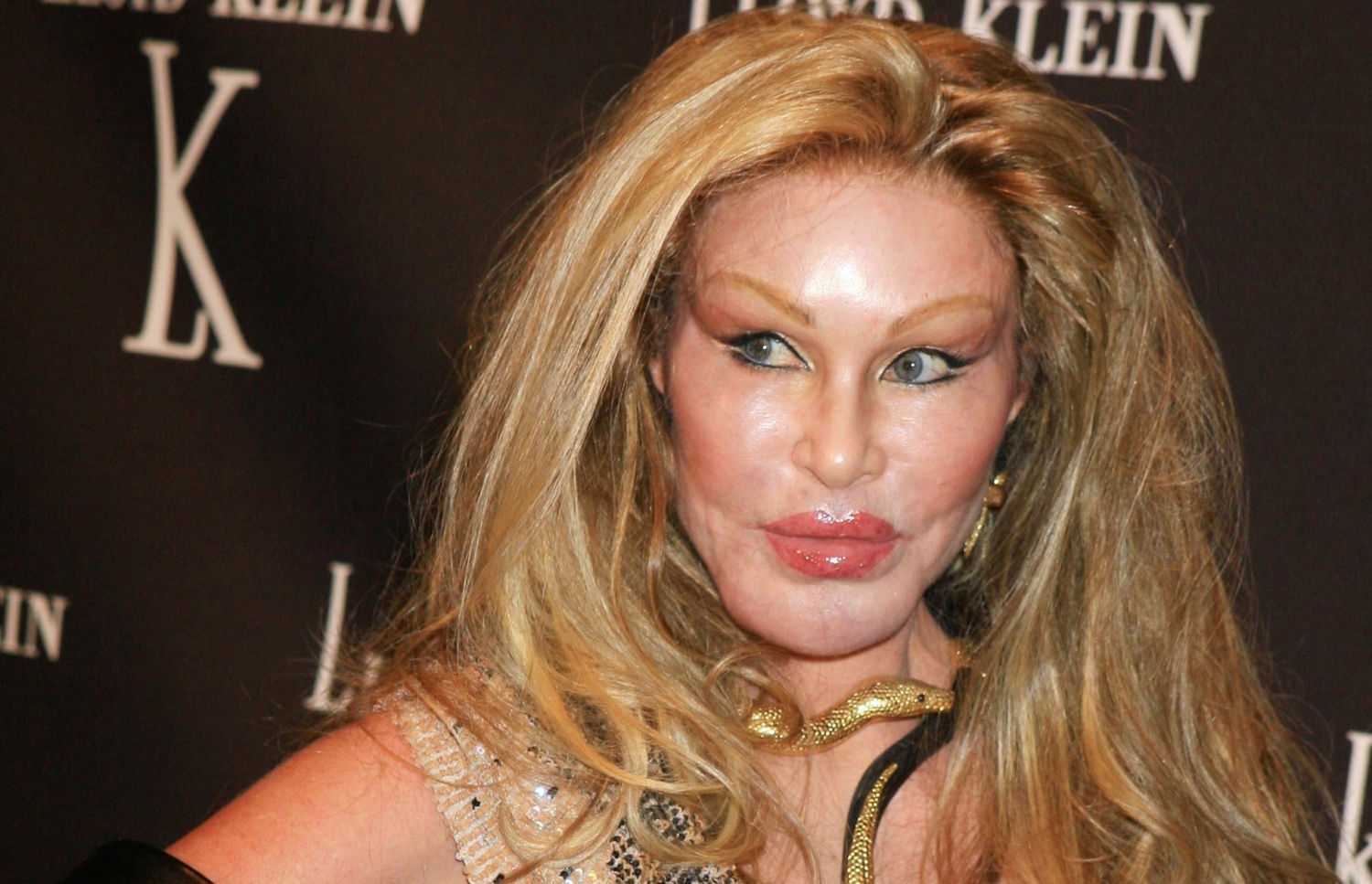 'Catwoman' Jocelyn Wildenstein Dies Due to Pulmonary Embolism 