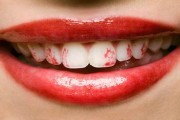Lipstick on Teeth