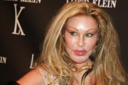'Catwoman' Jocelyn Wildenstein Dies Due to Pulmonary Embolism 